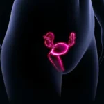 Как нормализовать цикл без таблеток: питание и образ жизни