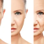 Что влияет на старение кожи и как замедлить процесс